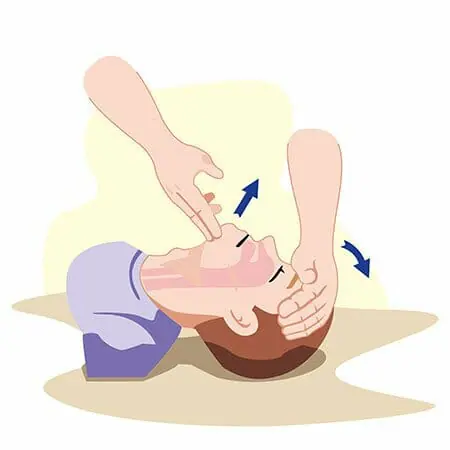 Chocking-CPR