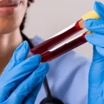 Common-Risks-of-Bloodborne-Pathogen-Exposure-for-Healthcare-Workers-Post-img