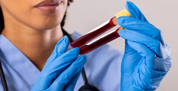 Common-Risks-of-Bloodborne-Pathogen-Exposure-for-Healthcare-Workers-Post-img