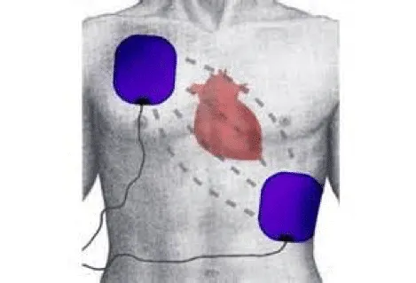 operate-AEDs-img