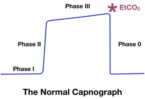 phase-3-img