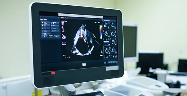 Echocardiogram What It Reveals About Your Heart Health post img