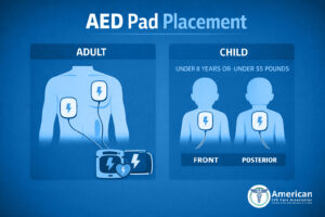 AED Pad placement ACCA